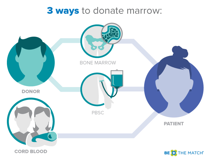 Three ways to donate bone marrow infographic